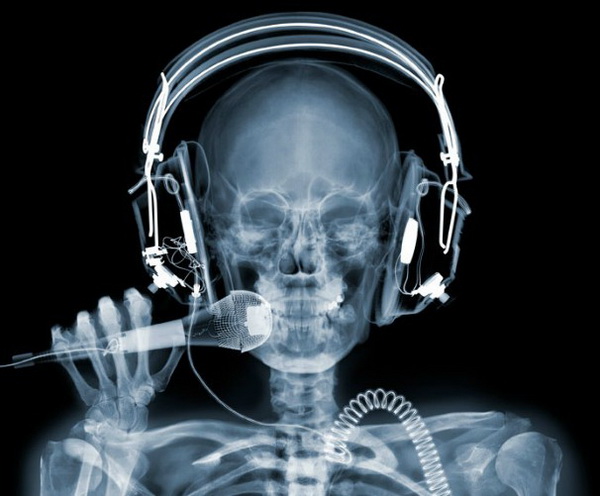 Nick Veasey röntgenfotói